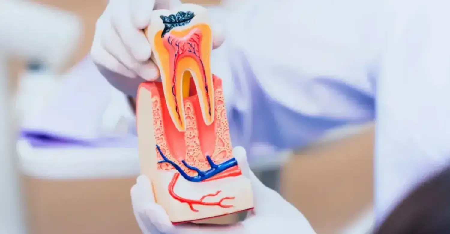 Essential Root Canal Therapy 2